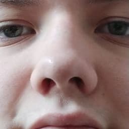 Fryzicko
