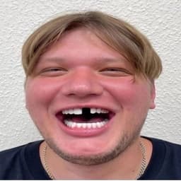 Kuponk