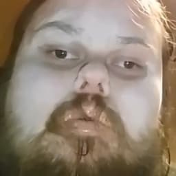 znr
