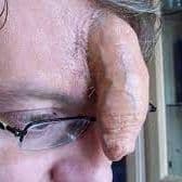 Ryzerok