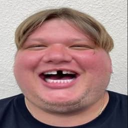 otsoss1mple