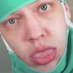 pikkupunkero