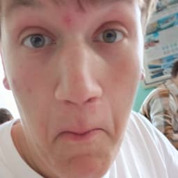 merd3x
