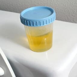 YellowUrine