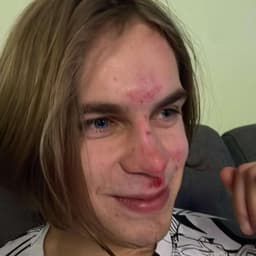 IZI09