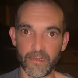 lacostidodo