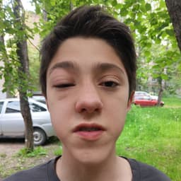 darvod