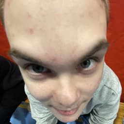 zQZz
