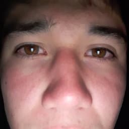 DuvitoRobin